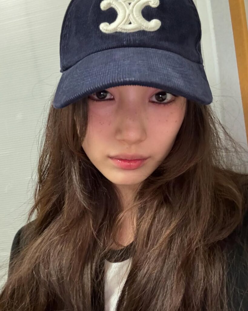 【印象がガラリ!】アイドル出身の国民的女優が目の中のホクロを除去! 2 【印象がガラリ!】アイドル出身の国民的女優が目の中のホクロを除去! スジ